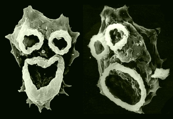 Ameba-zumbi-comedora-de-cerebros