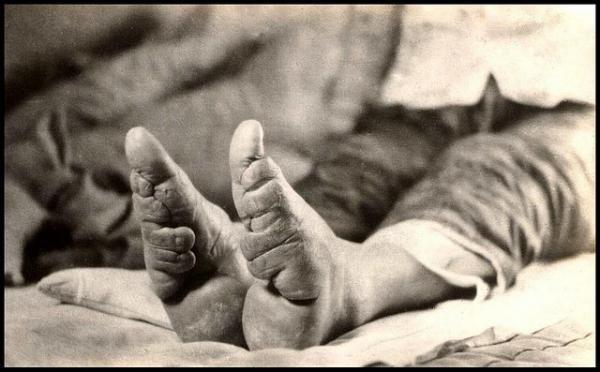 Foot binding used to be really, really popular.