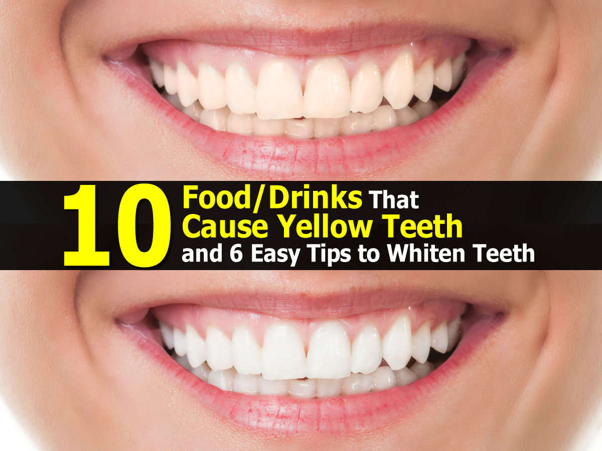 food-drinks-cause-yellow-teeth